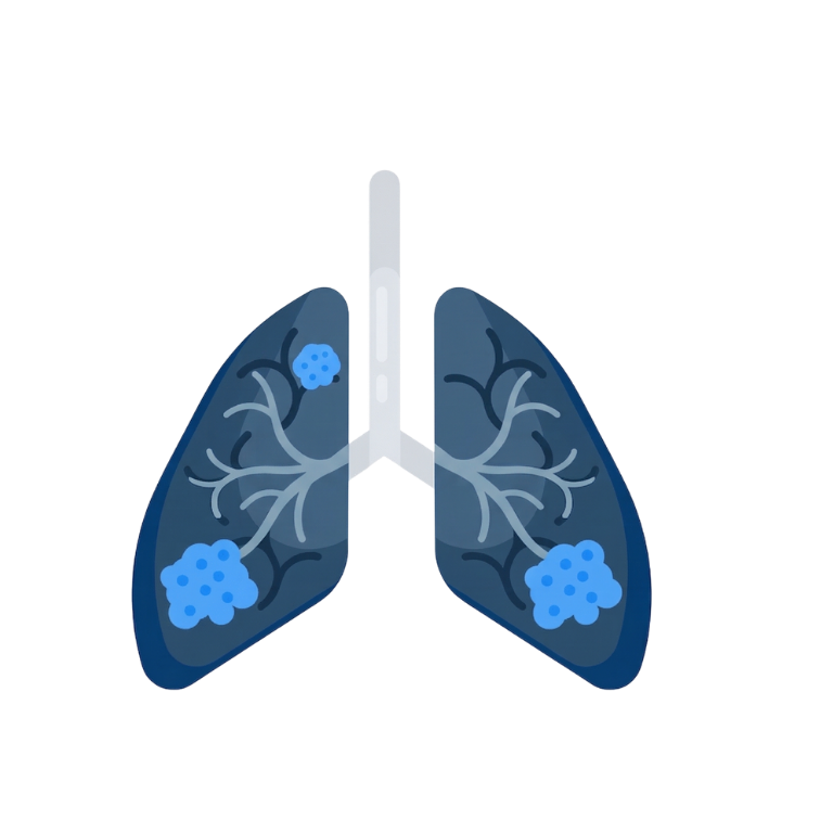 Lung Cancer
